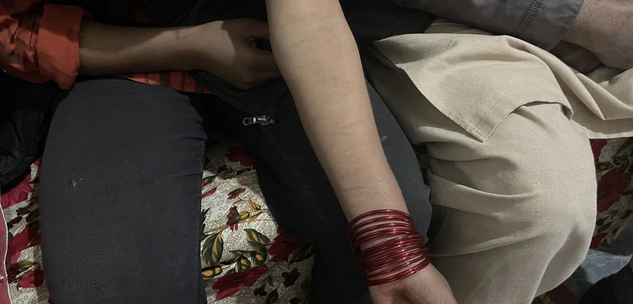 braccio di ragazza che presenta cicatrici da tagli. csi